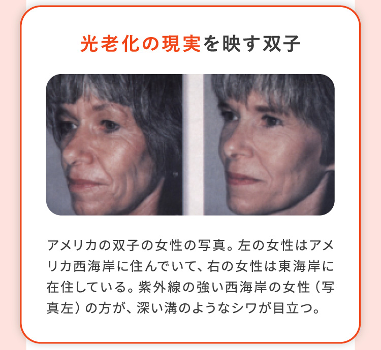 光老化の現実を映す双子