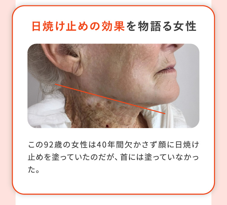 日焼け止めの効果を物語る女性